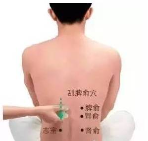  腰后背着凉试试刮痧